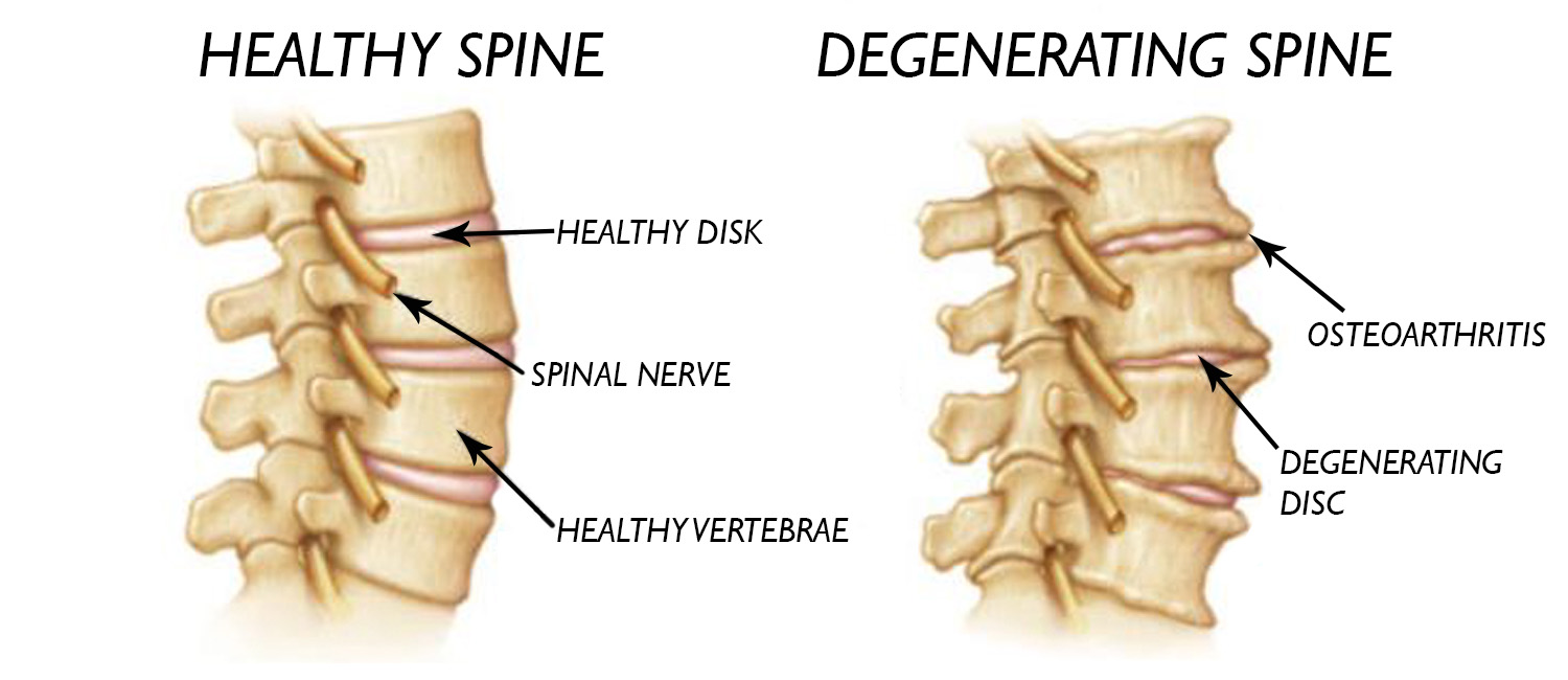 arthritis-doctor-orange-county-mission-viejo-winchell-chiropractic