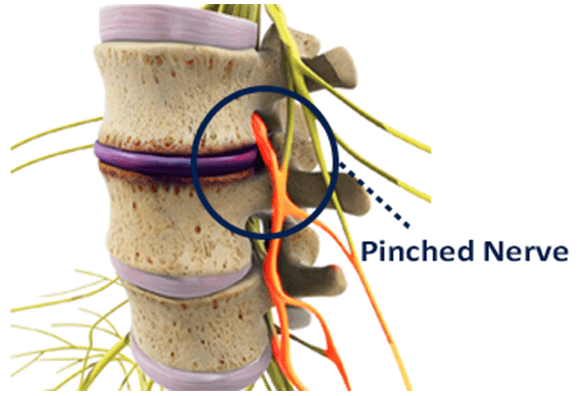 Chiropractic Care For Pain Relief, Mission Viejo at Winchell Chiropractic