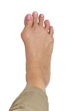 Foot Doctor For Foot & Ankle Pain Relief, CA at Winchell Chiropractic